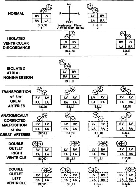 van praagh classification